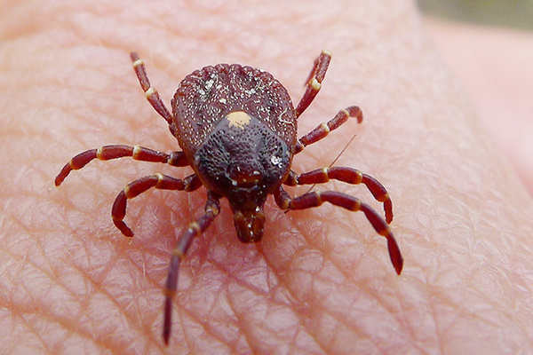 Tick on skin