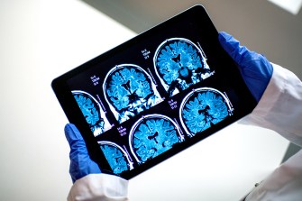 A view of MRI scans is held by a technician.