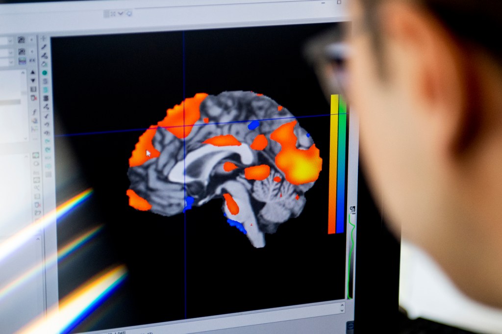 computer display of various parts of the brain lit up in red