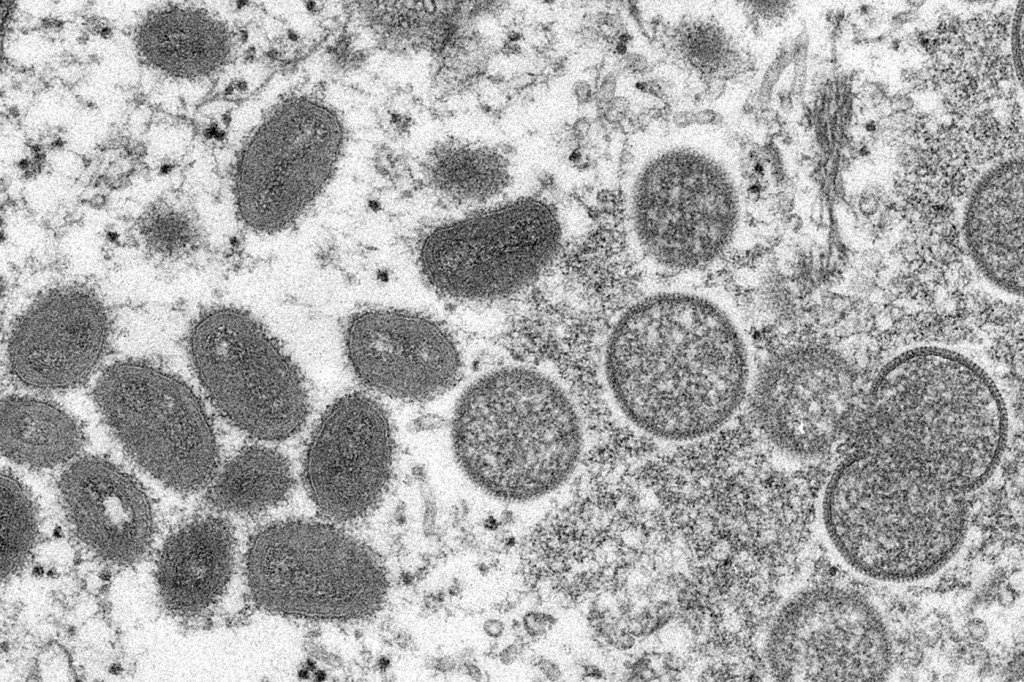 This 2003 electron microscope image made available by the Centers for Disease Control and Prevention shows mature, oval-shaped monkeypox virions, left, and spherical immature virions, right, obtained from a sample of human skin associated with the 2003 prairie dog outbreak. Monkeypox, a disease that rarely appears outside Africa, has been identified by European and American health authorities in recent days.