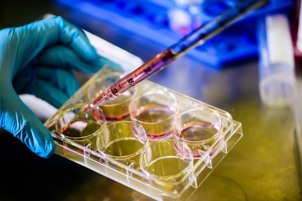 A tray of cultures held by a gloved hand in a lab