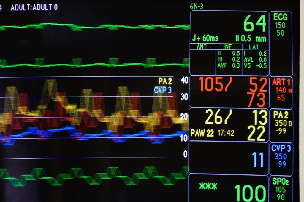 data on icu monitor screen