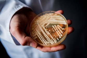 petri dish of yeast candida auris