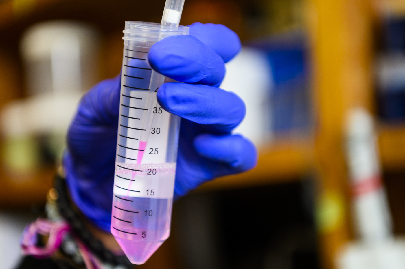 gloved hand filling a pipette from a test tube