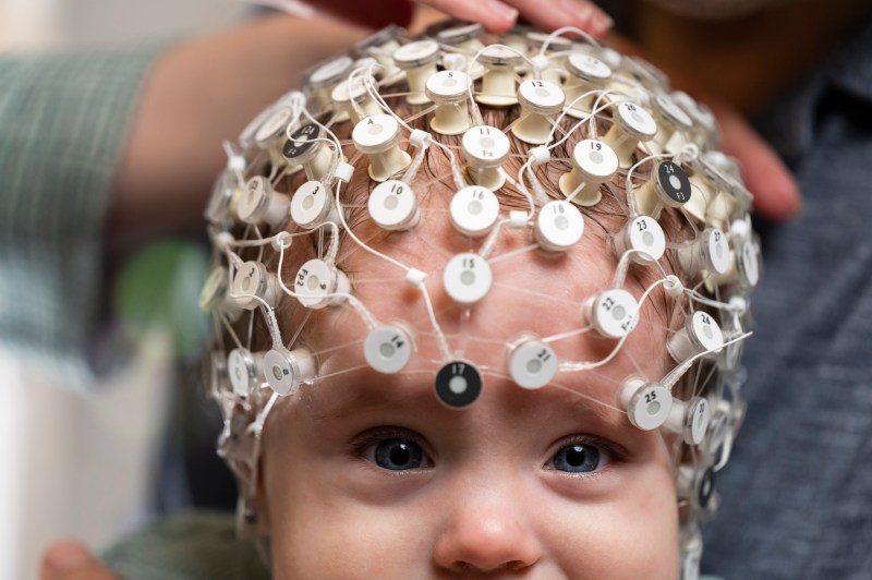 A baby with a neuroimaging device on its head.