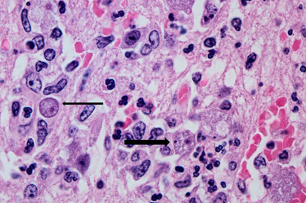 A brain eating amoeba under a microscope.