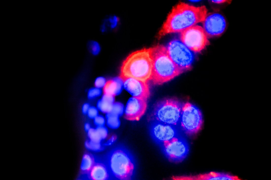 Molecular imaging that shows pink and purple spots on a dark background.