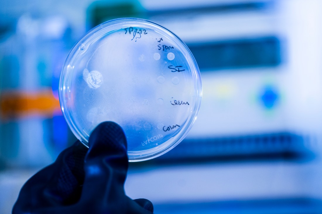 A gloved hand holds up a petri dish.