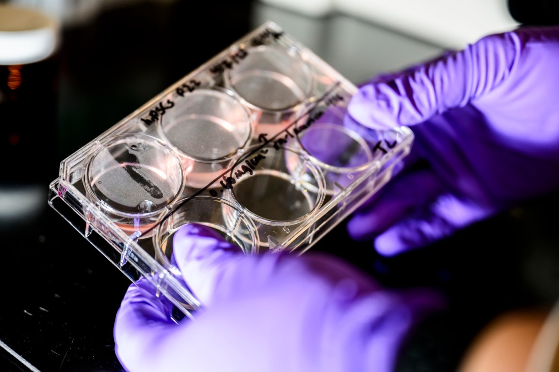 Rebecca Kuntz Willis holding a lab sample with gloved hands.