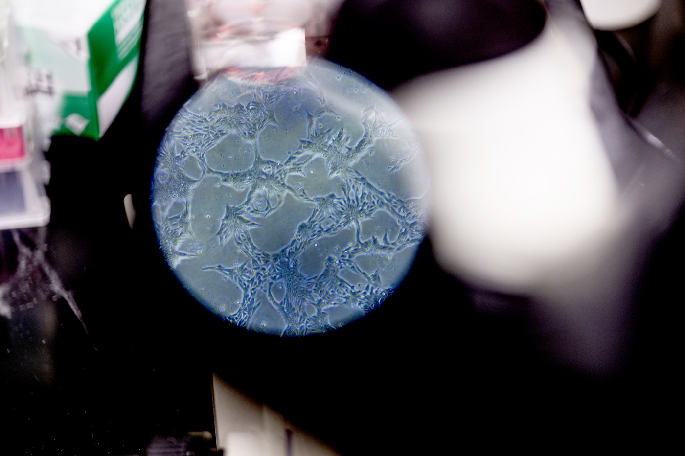 Protein cells seen under a micrscope lens.