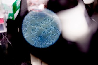 A protein magnified under a microscope lens.