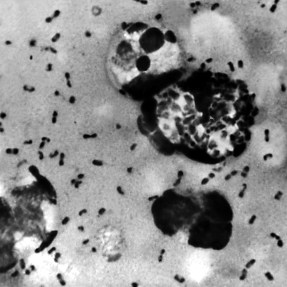 A zoomed in shot of the Pneumonic plague.